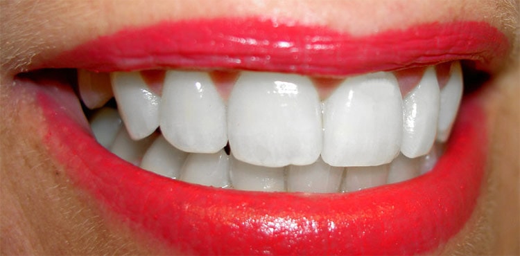How to Whiten Teeth in Photoshop